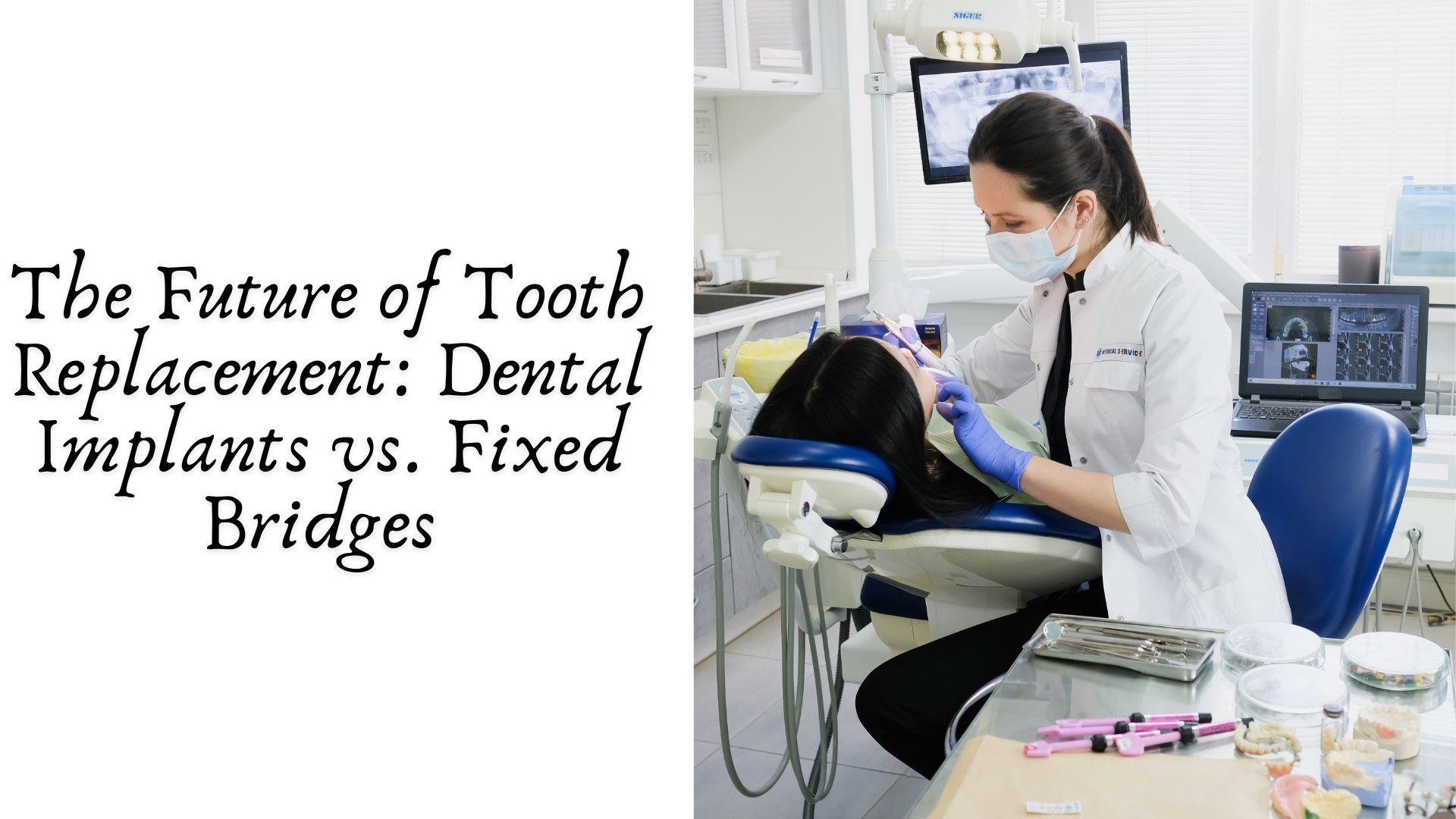 The Future of Tooth Replacement Dental Implants vs. Fixed Bridges