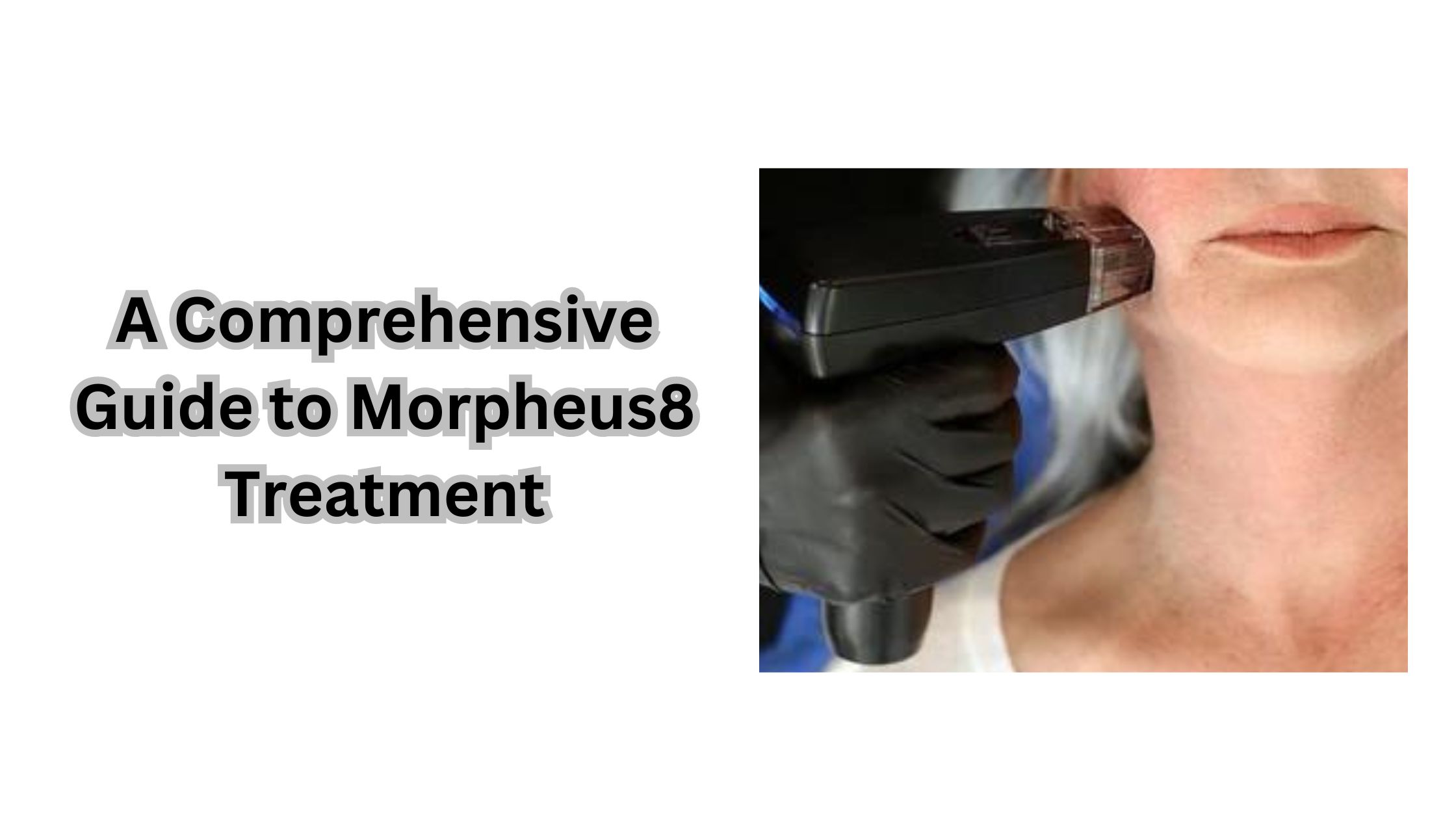 A Comprehensive Guide to Morpheus8 Treatment (3)