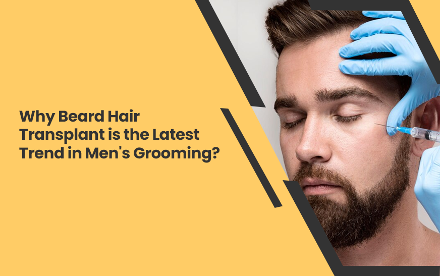 Why Beard Hair Transplant is the Latest Trend in Men’s Grooming?