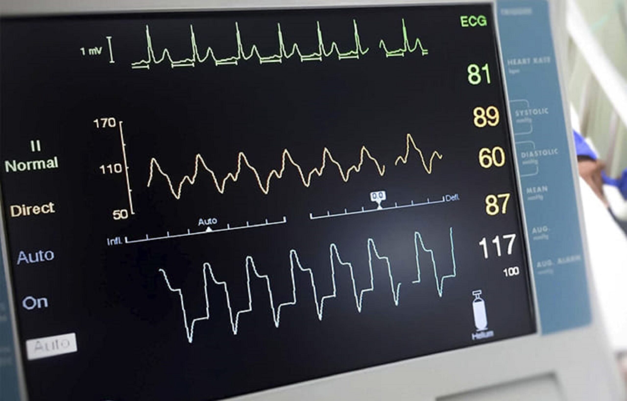 The Role of Internal Medicine in Managing Diabetes