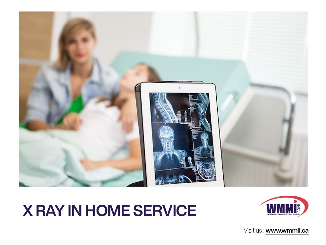 X Ray In Home Service