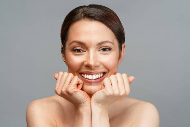 Skin Whitening Treatment: Understanding the Options, Benefits, and Risks