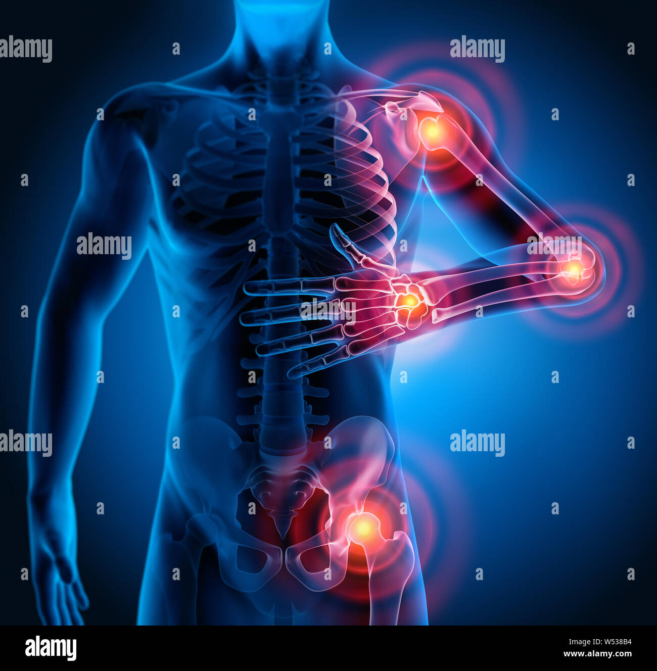 man-male-body-with-painful-joints-3d-illustration-W538B4 (1)