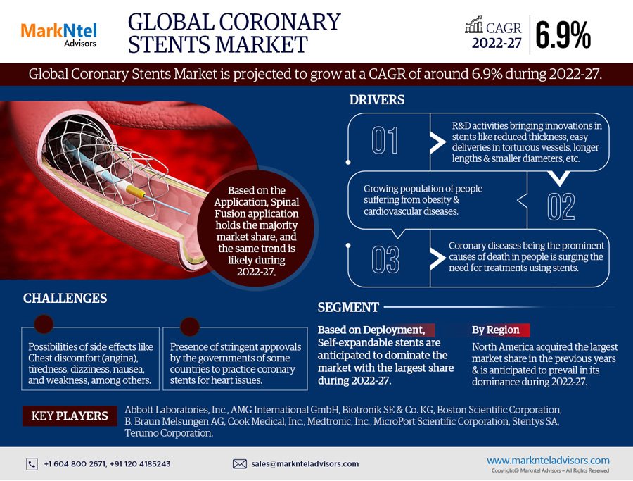 Exploring Coronary Stents Market: Rising Trends, Opportunities and Challenges Forecast 2027