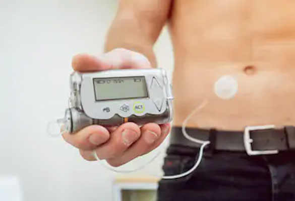 India Insulin Pumps Market