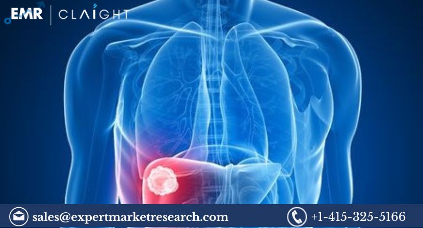 North America Tumor Ablation Market (2)