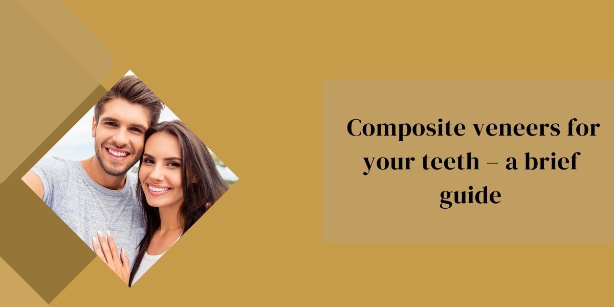 Composite veneers