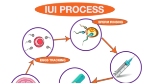 IUI Treatments