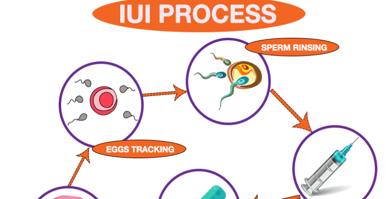 IUI Treatments