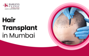 hair transplant in mumbai