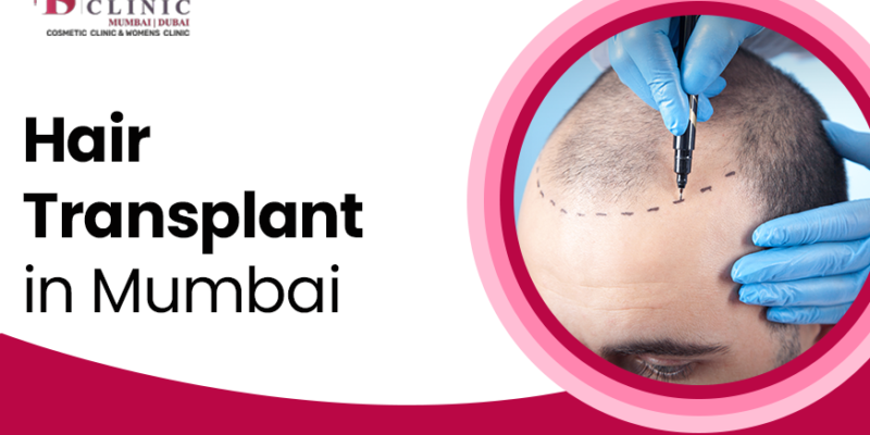 hair transplant in mumbai