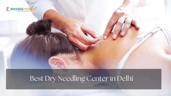 Best Dry Needling Center in Delhi-00