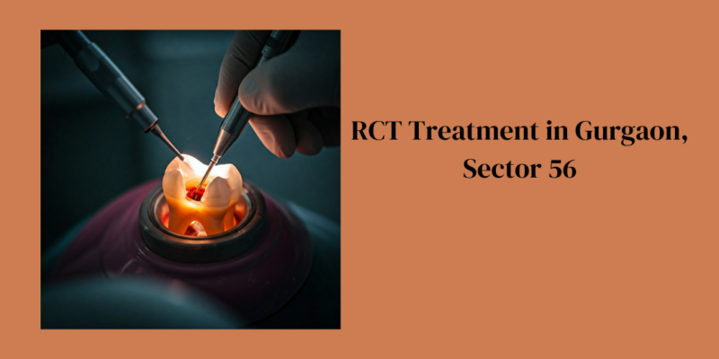 RCT Treatment in Gurgaon, Sector 56