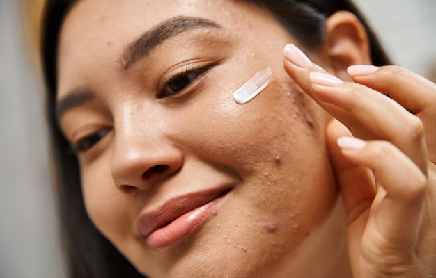 close-up-shot-young-asian-woman-with-brunette-hair-applying-acne-treatment-cream-face_1074916-4322.jpg (AVIF Image 626 × 417 pixels)