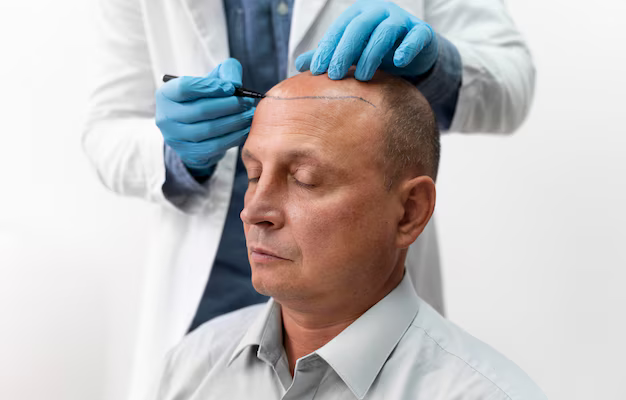 male-going-through-follicular-unit-extraction-process_23-2149106322.jpg (AVIF Image 626 × 417 pixels)