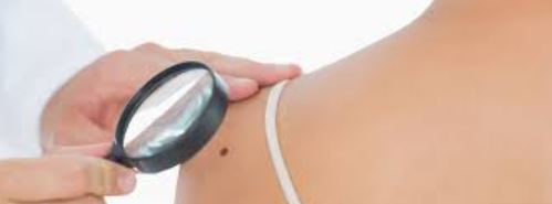 non-melanoma skin cancer treatment market