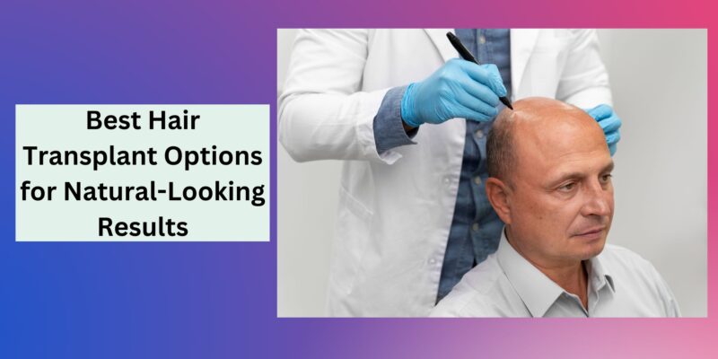 Best Hair Transplant Options for Natural-Looking Results (1)