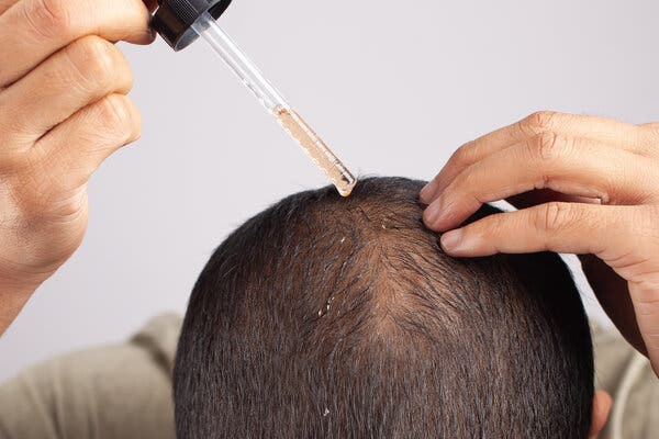 Restoring Your Hairline with the Latest Treatment Innovations