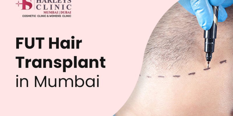 fut hair transplant mumbai