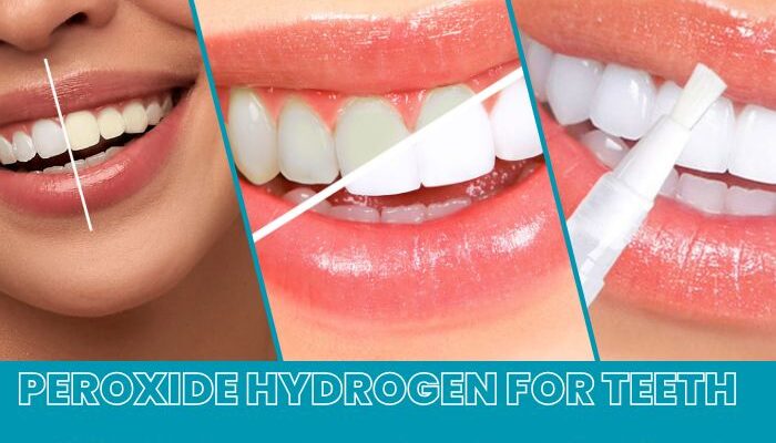 peroxide hydrogen for teeth