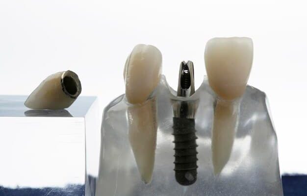 dentures-crown-implant_621486-2597