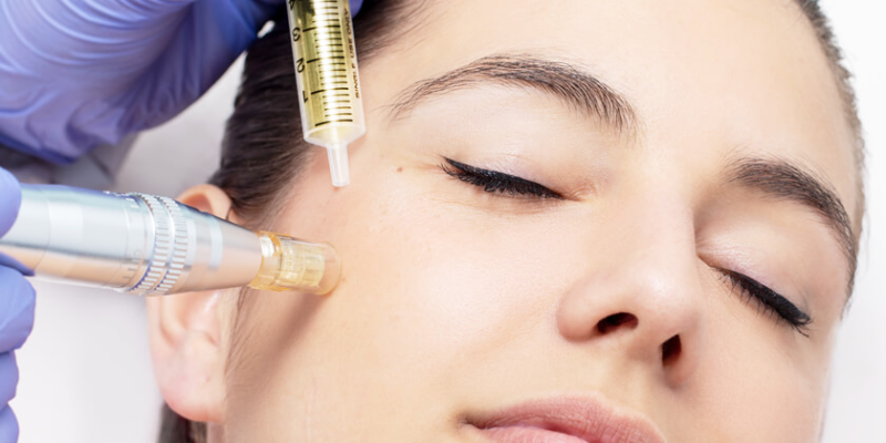 Mesotherapy in Dubai