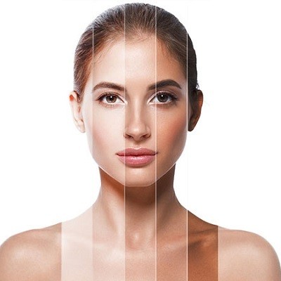 skin whitening in Islamabad Pakistan