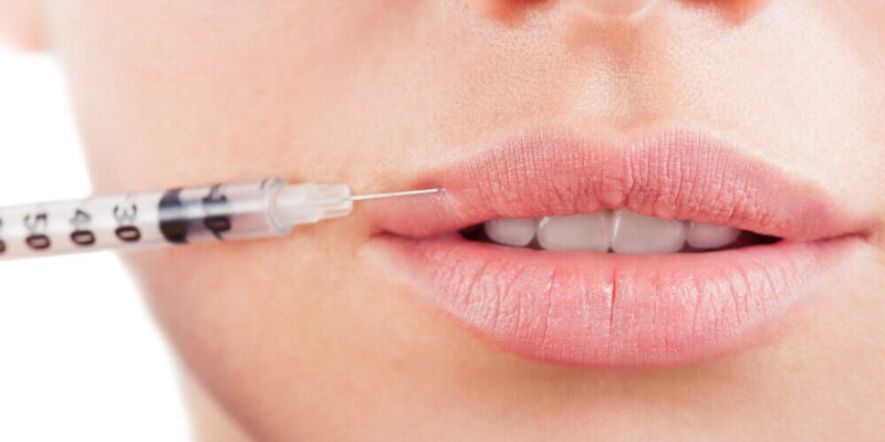 Lip Filler Injections in Dubai