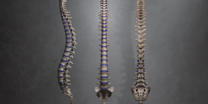 Spinal Osteosynthesis Units